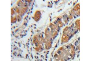 IHC-P analysis of Stomach tissue, with DAB staining. (CXCL5 抗体  (AA 45-118))