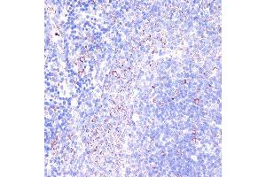 Immunohistochemistry (IHC) image for anti-Integrin beta 2 (ITGB2) (AA 70-170) antibody (ABIN3023118)