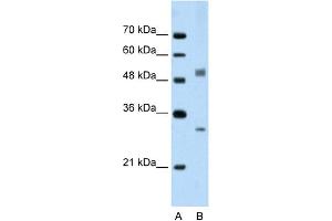 WB Suggested Anti-IRF6 Antibody Titration:  2. (IRF6 抗体  (C-Term))