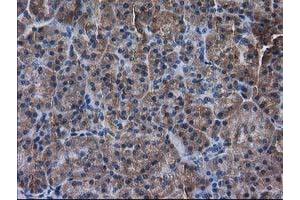 Immunohistochemical staining of paraffin-embedded Human pancreas tissue using anti-DSTN mouse monoclonal antibody. (Destrin 抗体)