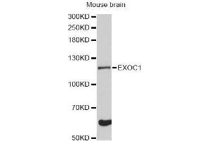 Western blot analysis of extracts of mouse brain, using EXOC1 Antibody (ABIN5996713) at 1:3000 dilution. (EXOC1 抗体)