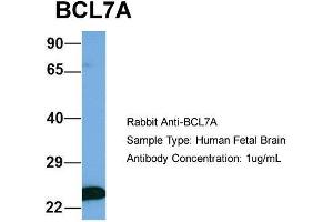 Host: Rabbit  Target Name: BCL7A  Sample Tissue: Human Fetal Brain  Antibody Dilution: 1. (BCL7A 抗体  (Middle Region))