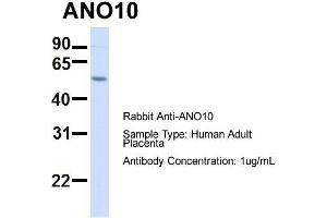 Host:  Rabbit  Target Name:  ANO10  Sample Type:  Human Adult Placenta  Antibody Dilution:  1. (Anoctamin 10 抗体  (C-Term))