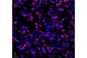 Immunofluorescence (Paraffin-embedded Sections) (IF (p)) image for anti-TEA Domain Family Member 3 (TEAD3) antibody (ABIN7075852)