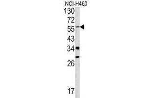 Western blot analysis of Y antibody (C-term) (ABIN390480 and ABIN2840844) in NCI- cell line lysates (35 μg/lane). (YAP1 抗体  (C-Term))