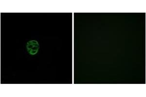 Immunofluorescence analysis of A549 cells, using OR2AE1 Antibody. (Olfactory Receptor, Family 2, Subfamily AE, Member 1 (OR2AE1) (AA 231-280) 抗体)