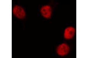 ABIN6268834 staining HeLa cells by IF/ICC. (DUSP1 抗体  (C-Term))