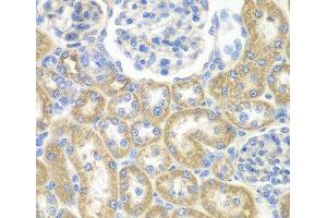 Immunohistochemistry of paraffin-embedded Rat kidney using GNAI2 Polyclonal Antibody at dilution of 1:100 (40x lens). (GNAI2 抗体)