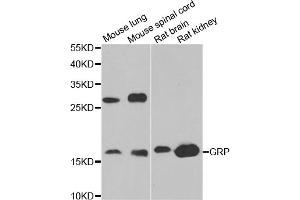 Western blot analysis of extracts of various cell lines, using GRP antibody (ABIN5973785) at 1/1000 dilution. (Gastrin-Releasing Peptide 抗体)