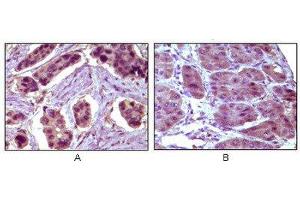 Immunohistochemistry (IHC) image for anti-B-Cell CLL/lymphoma 10 (BCL10) antibody (ABIN1842926) (BCL10 抗体)