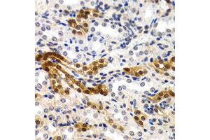 Immunohistochemistry of paraffin-embedded rat kidney using MT2A antibody at dilution of 1:200 (400x lens). (MT2A 抗体)