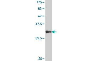 Western Blot detection against Immunogen (42. (JTB 抗体  (AA 1-146))