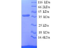 SDS-PAGE (SDS) image for Reticulocalbin 1, EF-Hand Calcium Binding Domain (RCN1) (AA 31-331), (partial) protein (His tag) (ABIN5714328)