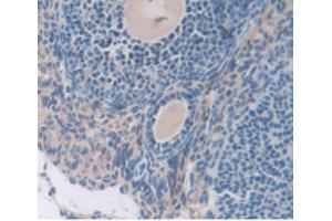 IHC-P analysis of Mouse Ovary Tissue, with DAB staining. (SERPING1 抗体  (AA 397-495))