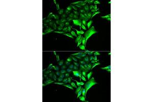 Immunofluorescence analysis of MCF-7 cells using PYGB antibody. (PYGB 抗体  (AA 544-843))