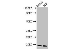 Western Blot Positive WB detected in: HepG2 whole cell lysate, PC-3 whole cell lysate All lanes: CAV2 antibody at 3 μg/mL Secondary Goat polyclonal to rabbit IgG at 1/50000 dilution Predicted band size: 19, 17, 13 kDa Observed band size: 19 kDa (Caveolin 2 抗体  (AA 3-64))