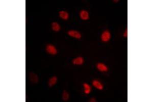 Immunofluorescent analysis of GRP75 staining in NIH3T3 cells. (HSPA9 抗体  (C-Term))