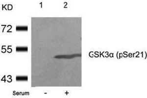Image no. 3 for anti-Glycogen Synthase Kinase 3 alpha (GSK3a) (pSer21) antibody (ABIN196620) (GSK3 alpha 抗体  (pSer21))