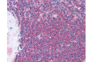 Anti-LCK antibody IHC of human spleen. (LCK 抗体  (AA 22-36))