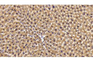 Immunohistochemistry (IHC) image for anti-phosphorylase, Glycogen, Liver (PYGL) (AA 370-538) antibody (ABIN7438019)