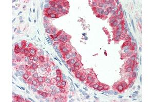 Human, Prostate:Formalin-Fixed Paraffin-Embedded (FFPE). (TROVE2 抗体  (AA 20-69))