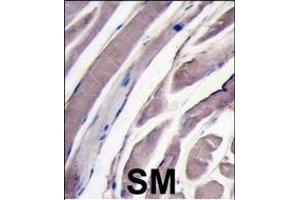 Formalin-fixed and paraffin-embedded human skeletal muscle tissue reacted with HK2 antibody (N-term), which was peroxidase-conjugated to the secondary antibody, followed by DAB staining. (Hexokinase 2 抗体  (N-Term))