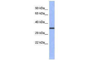 WB Suggested Anti-WNT4 Antibody Titration:  0. (WNT4 抗体  (Middle Region))