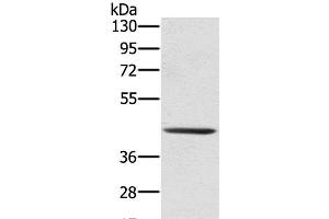 Western Blot analysis of 231 cell using SCPEP1 Polyclonal Antibody at dilution of 1:300 (SCPEP1 抗体)