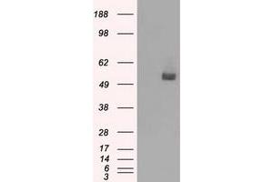 Western Blotting (WB) image for anti-CD36 (CD36) antibody (ABIN1497274) (CD36 抗体)
