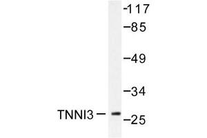 Image no. 1 for anti-Cardiac Troponin I (TNNI3) antibody (ABIN271938) (TNNI3 抗体)