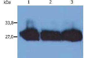 Western Blotting analysis (reducing conditions) of human blood sera using anti-human Immunoglobulin kappa-chain (MEM-09). (kappa Light Chain 抗体)