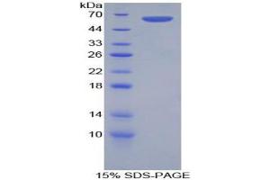 SDS-PAGE analysis of Rat FOS Like Antigen 1 Protein. (FOSL1 蛋白)