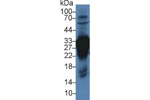 Western blot analysis of Rat Liver lysate, using Rat CA3 Antibody (3 µg/ml) and HRP-conjugated Goat Anti-Rabbit antibody ( (CA3 抗体  (AA 27-217))