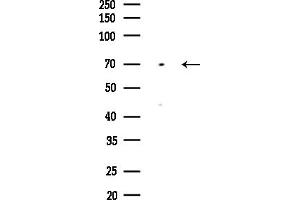 Western blot analysis of lysates from MDA-MB-231 cells(heat-shock,45 min treatment), using PPP2R5D Antibody at 1/1000 dilution.