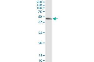 Immunoprecipitation of MECR transfected lysate using anti-MECR MaxPab rabbit polyclonal antibody and Protein A Magnetic Bead , and immunoblotted with MECR purified MaxPab mouse polyclonal antibody (B01P) . (MECR 抗体  (AA 1-373))