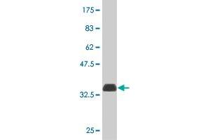 Western Blot detection against Immunogen (33. (ATOX1 抗体  (AA 1-68))