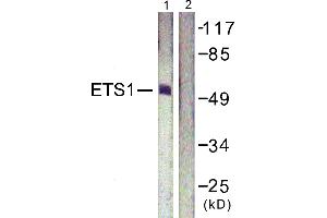 Immunohistochemistry analysis of paraffin-embedded human lung carcinoma tissue using ETS1 (Ab-38) antibody. (ETS1 抗体  (Thr38))