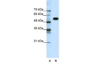 WB Suggested Anti-CLCNKB Antibody Titration:  0. (CLCNKB 抗体  (N-Term))