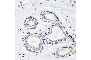 Immunohistochemistry of paraffin-embedded Human breast using SUN2 Rabbit pAb (ABIN7270136) at dilution of 1:100 (40x lens). (SUN2 抗体)