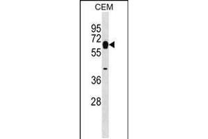 Western blot analysis in CEM cell line lysates (35ug/lane). (Myotilin 抗体  (AA 127-155))