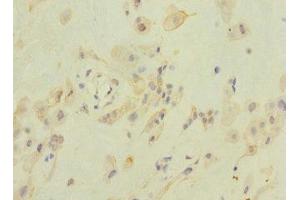 Immunohistochemistry of paraffin-embedded human placenta tissue using ABIN7176632 at dilution of 1:100 (ZFPM2 抗体  (AA 982-1151))
