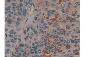 Immunohistochemistry (IHC) image for anti-Pyruvate Kinase M2 (PKM2) (AA 141-248) antibody (ABIN7432133)