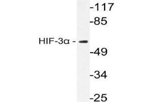 Western blot analysis of HIF3A Antibody in extracts from Rat brain cells. (HIF3A 抗体)