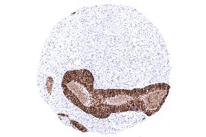 Endocervix (Recombinant Mammaglobin 抗体)
