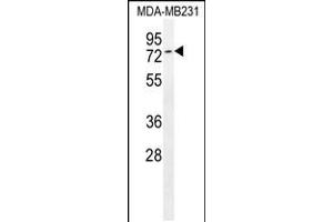 Western blot analysis in MDA-MB231 cell line lysates (35ug/lane). (Tiparp 抗体  (C-Term))