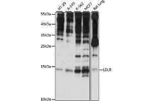 Western blot analysis of extracts of various cell lines, using SNRNP25 antibody (ABIN7270360) at 1:1000 dilution. (SNRNP25 抗体  (AA 1-132))