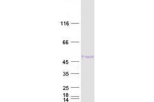 Validation with Western Blot