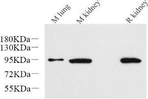 Western Blot analysis of various samples using Catenin beta Monoclonal Antibody at dilution of 1:1000. (beta Catenin 抗体)