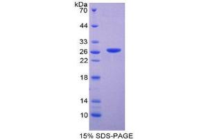 SDS-PAGE (SDS) image for Deoxyribonuclease I-Like 2 (DNASE1L2) (AA 28-232) protein (His tag) (ABIN2124612)