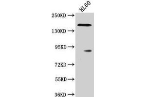 Western Blot Positive WB detected in: HL60 whole cell lysate All lanes: ROCK1 antibody at 1:2000 Secondary Goat polyclonal to rabbit IgG at 1/50000 dilution Predicted band size: 159 kDa Observed band size: 159 kDa (ROCK1 抗体  (AA 405-668))